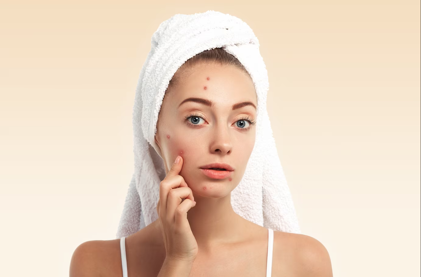 Achieving Clear Skin: Effective Acne Treatments Explained